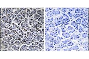 Immunohistochemistry analysis of paraffin-embedded human pancreas tissue, using PPM1K Antibody. (PPM1K Antikörper  (AA 205-254))