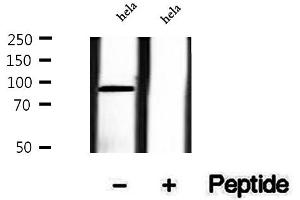 anti-Tousled-Like Kinase 1 (TLK1) (pSer743) antibody