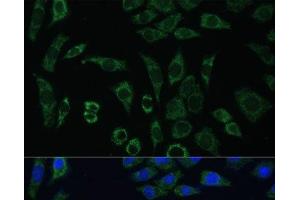 Immunofluorescence analysis of L929 cells using AEBP1 Polyclonal Antibody at dilution of 1:100 (40x lens). (AEBP1 Antikörper)