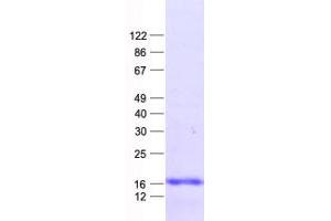 Western Blotting (WB) image for LIM Domain Only 3 (Rhombotin-Like 2) (LMO3) protein (His tag) (ABIN2730877)