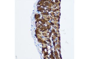 Immunohistochemistry of paraffin-embedded Rat lung using PP1 beta Rabbit pAb (ABIN3021408, ABIN3021409, ABIN3021410 and ABIN6215019) at dilution of 1:100 (40x lens). (PPP1CB Antikörper  (AA 1-327))