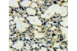 IHC-P analysis of Lung tissue, with DAB staining. (DEFB119 Antikörper  (AA 22-84))