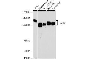 Western blot analysis of extracts of various cell lines, using  antibody  at 1:500 dilution. (ACE2 Antikörper)