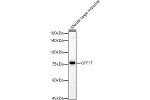 Western blot analysis of extracts of Mouse large intestine, using GFPT1 antibody (ABIN7267430) at 1:1000 dilution. (GFPT1 Antikörper)