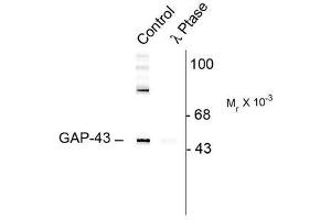 Image no. 1 for anti-Growth Associated Protein 43 (GAP43) (pSer41) antibody (ABIN372649) (GAP43 Antikörper  (pSer41))