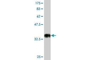 Western Blot detection against Immunogen (35. (CDADC1 Antikörper  (AA 423-514))