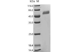 CD69 (CD69) (AA 62-199) protein (mFc Tag)