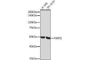 Western blot analysis of extracts of various cell lines, using P Rabbit mAb (ABIN7269441) at 1:1000 dilution. (PARP2 Antikörper)
