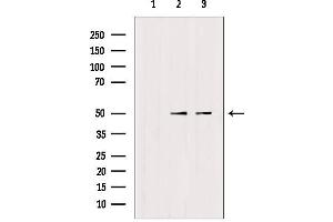 Western Blotting (WB) image for anti-Tripartite Motif Containing 24 (TRIM24) (C-Term) antibody (ABIN6265731)