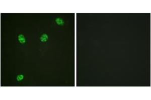 Immunofluorescence analysis of HeLa cells, using ERF (Phospho-Thr526) Antibody. (ERF Antikörper  (pThr56))
