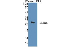 Figure. (DPEP2 Antikörper  (AA 303-486))