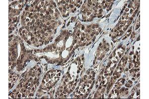 Image no. 3 for anti-Host Cell Factor C2 (HCFC2) antibody (ABIN1498601)