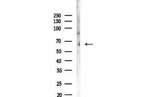 anti-Melanoma Antigen Family D, 2 (MAGED2) (N-Term) antibody