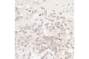 Immunohistochemistry (IHC) image for anti-Casein Kinase 2 alpha 1 (CSNK2A1) (AA 300-350) antibody (ABIN7454514) (CSNK2A1/CK II alpha Antikörper  (AA 300-350))