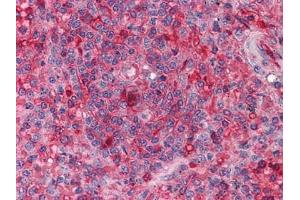 Immunohistochemical analysis of paraffin-embedded human Spleen tissues using anti-ARNTL antibody (ARNTL Antikörper)