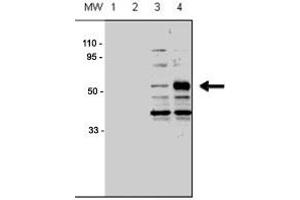 Western blot analysis of ACVRL1 polyclonal antibody  in human chondrocytes (C-28/I2 cells), transfected with empty vector (lane 1, 3) or ACVRL1 (lane 2, 4).
