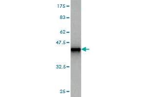 Western Blot detection against Immunogen (37. (FGF1 Antikörper  (AA 46-155))