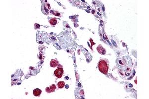 EIF2AK1 antibody was used for immunohistochemistry at a concentration of 4-8 ug/ml. (EIF2AK1 Antikörper  (N-Term))