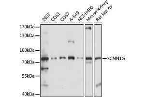 Western blot analysis of extracts of various cell lines, using SCNN1G antibody (ABIN7270387) at 1:1000 dilution. (SCNN1G Antikörper  (AA 100-250))