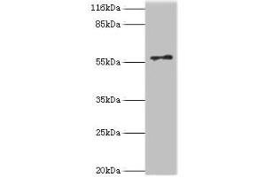 Western blot All lanes: RAD18 antibody at 2 μg/mL + COLO205 whole cell lysate Secondary Goat polyclonal to rabbit IgG at 1/10000 dilution Predicted band size: 57 kDa Observed band size: 57 kDa (RAD18 Antikörper  (AA 1-495))