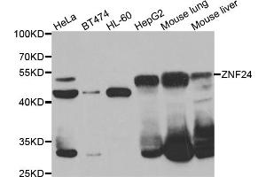 Western blot analysis of extracts of various cell lines, using ZNF24 antibody (ABIN5975578) at 1/1000 dilution. (ZNF24 Antikörper)