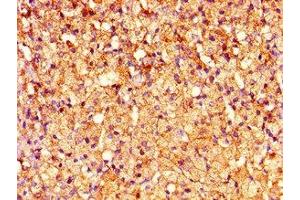 Immunohistochemistry (IHC) image for anti-Corticotropin Releasing Hormone Receptor 2 (CRHR2) (AA 20-108) antibody (ABIN7148633)