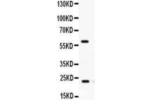 Observed bind size: 24KD,60KD (RAB11A Antikörper  (C-Term))