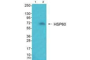 Western blot analysis of extracts from JK cells (Lane 2), using HSP60 antiobdy. (HSPD1 Antikörper)