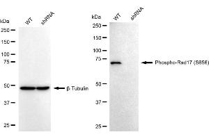 Western blotting analysis using phospho-Rad17 (S656) antibody (ABIN7800113).
