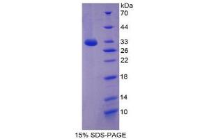 SDS-PAGE (SDS) image for Mitogen-Activated Protein Kinase 10 (MAPK10) (AA 88-332) protein (His tag) (ABIN2125893) (MAPK10 Protein (AA 88-332) (His tag))