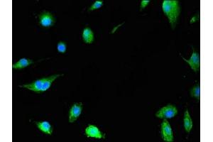 Immunofluorescent analysis of U251 cells using ABIN7155043 at dilution of 1:100 and Alexa Fluor 488-congugated AffiniPure Goat Anti-Rabbit IgG(H+L) (c-MET Antikörper  (AA 83-209))