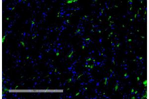 Immunohistochemistry analysis using Mouse Anti-VPS35 Monoclonal Antibody, Clone 8A3 (ABIN6932968). (VPS35 Antikörper  (Biotin))