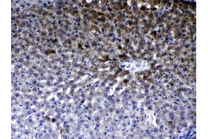 IHC analysis of ErbB 2 using anti- ErbB 2 antibody .