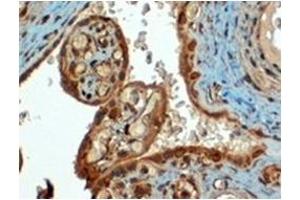 Image no. 3 for anti-CD274 (PD-L1) (C-Term) antibody (ABIN374512) (PD-L1 Antikörper  (C-Term))