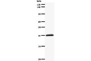 Western Blotting (WB) image for anti-Nuclear Factor (erythroid-Derived 2)-Like 2 (NFE2L2) antibody (ABIN931118) (NRF2 Antikörper)