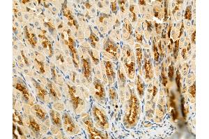 anti-Gse1 coiled-coil protein (GSE1) (Internal Region) antibody