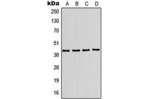 Western blot analysis of Kir4. (KCNJ10 Antikörper  (Center))