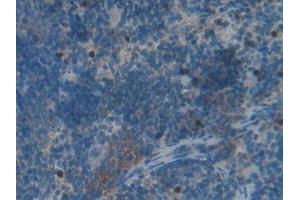 Immunohistochemistry (IHC) image for anti-HSPA Binding Protein, Cytoplasmic Cochaperone 1 (HSPBP1) (AA 198-352) antibody (ABIN7437581)