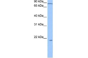 WB Suggested Anti-ARPC3 Antibody Titration: 0. (ARPC3 Antikörper  (N-Term))