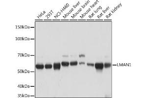 Western blot analysis of extracts of various cell lines, using LM Rabbit mAb (ABIN7268205) at 1:1000 dilution. (LMAN1 Antikörper)