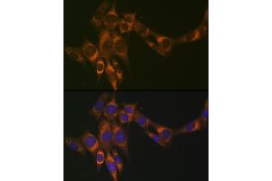 Immunofluorescence analysis of NIH-3T3 cells using ACADM Rabbit mAb (ABIN1678538, ABIN3019056, ABIN3019057 and ABIN7101707) at dilution of 1:100 (40x lens). (Medium-Chain Specific Acyl-CoA Dehydrogenase, Mitochondrial Antikörper)