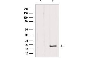 Western blot analysis of extracts from Hela, using SRP14 antibody. (SRP14 Antikörper  (Internal Region))