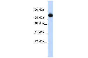 WB Suggested Anti-PATZ1 Antibody Titration:  0.