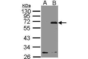 WB Image Western Blot analysis of NET1 expression in transfected 293T cell line by NET1 polyclonal antibody. (NET1 Antikörper  (C-Term))