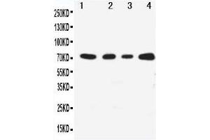 Anti-MEKK3 antibody, Western blotting Lane 1: HELA Cell Lysate Lane 2: A431 Cell Lysate Lane 3: MCF-7 Cell Lysate Lane 4: JURKAT Cell Lysate