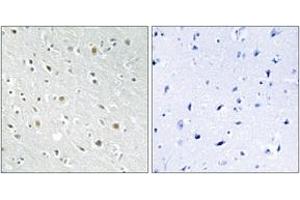 Immunohistochemistry analysis of paraffin-embedded human brain tissue, using SSBP2 Antibody. (SSBP2 Antikörper  (AA 10-59))