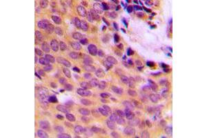 Immunohistochemistry (IHC) image for anti-Matrix Metallopeptidase 9 (Gelatinase B, 92kDa Gelatinase, 92kDa Type IV Collagenase) (MMP9) (C-Term) antibody (ABIN7296322)