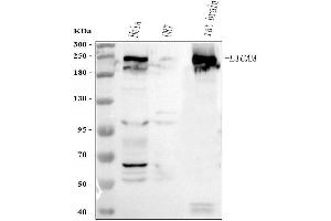 Western blot analysis of L1CAM using anti-L1CAM antibody (ABIN7600711).