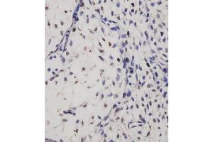 (ABIN6244107 and ABIN6577237) staining SUFU in mouse embryo tissue sections by Immunohistochemistry (IHC-P - paraformaldehyde-fixed, paraffin-embedded sections). (SUFUH Antikörper)