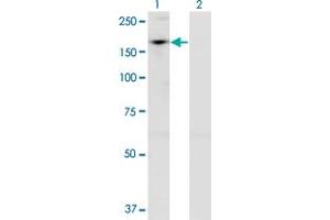 Western Blot analysis of ADNP expression in transfected 293T cell line by ADNP monoclonal antibody (M02), clone 2C5. (ADNP Antikörper  (AA 1018-1102))
